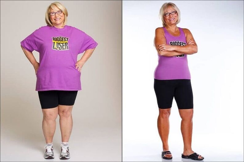 Women before and after losing weight